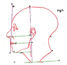 Camper's Facial Angle